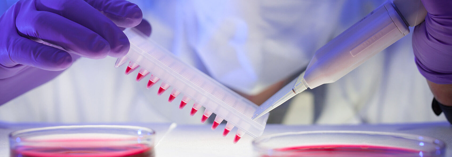 Fluid being put into a testing tray in a lab.